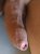 Dickpic