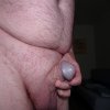 Bare head of penis