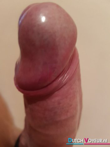 Penis