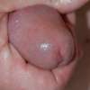 eikel